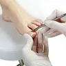 Зняття та педикюр