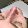 Миндальный пилинг