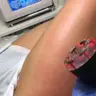 Антицеллюлитный массаж +Rf lifting (Бедра+Ягодицы)