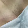 Глибоке бікіні
