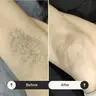 Пахви