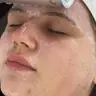 Glow Skin ендосфера обличчя