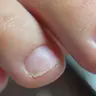 Апаратний педикюр