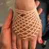 Шрами та розтяжки