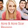 Лазерне лікування акне обличчя- Fotona Acne®