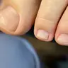 Педикюр гігієнічний