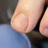 Педикюр гігієнічний
