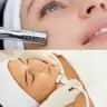 Anti-Aging & Hautverjüngung mit Radiofrequenz: Für strahlende, feste und jugendliche Haut