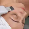 Чистка обличчя ультразвукова