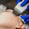 Чистка обличчя комбінована