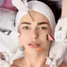 Глубокая 12-ти этапная чистка + с коктейлем из трех пилингов