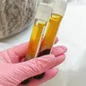 Плазмоліфтинг обличчя (2 пробірки)