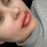 Nachbehandlung