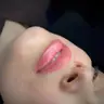 Auffrischung
