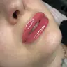 Lippen