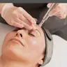 MICRONEEDLING