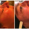 Behandlung von Augen-Lachfältchen