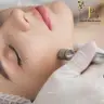 Mikrodermabrasion