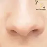 Nase