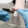 Забір на аналіз грибка нігтя