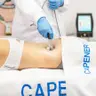 Anti-Cellulite-Programm für straffe Haut- Capernergy Technologie ( Rücken oder Bauch - 10 Sessionen)