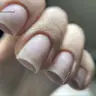 Gel-Lack Entfernung