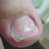 Зняття Кор.Ниті