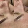 Чистка обличчя + пілінг