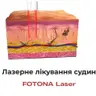 Лазерне видалення судин на обличчі (ТАЕ)* - 1 імпульс
