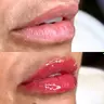 Hidragloss