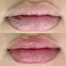 Spa Labial