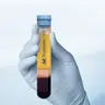 *PRP терапія Tropocells