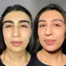 eyebrow correction