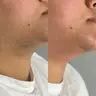Pescoço
