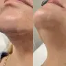 Pescoço
