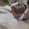 Laser Hollywood Peel ab 100€