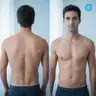 Herren Laser Paket - Rücken komplett & Bauch