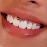 PIERCING BOCA: Gengiva (Smiley)