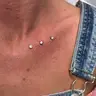 Remoção Microdermal
