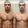 Herren Laser Haarentfernung Bauch