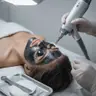 Carbon Peeling