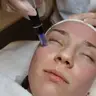 LIMPIEZA FACIAL