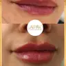 LABIOS HYALURONPEN