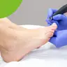 Medizinische Fußpflege