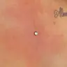 PIERCING CORPORAL: Microdermal