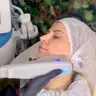 SMAS LIFTING Підтяжка нижньої третини обличия
