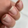 Чистка