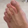 Виготовлення середнього ортозу
