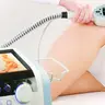 RF-LFTING На апараті-BTL EXILIS ELITE-Боки