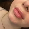 Hydra lips